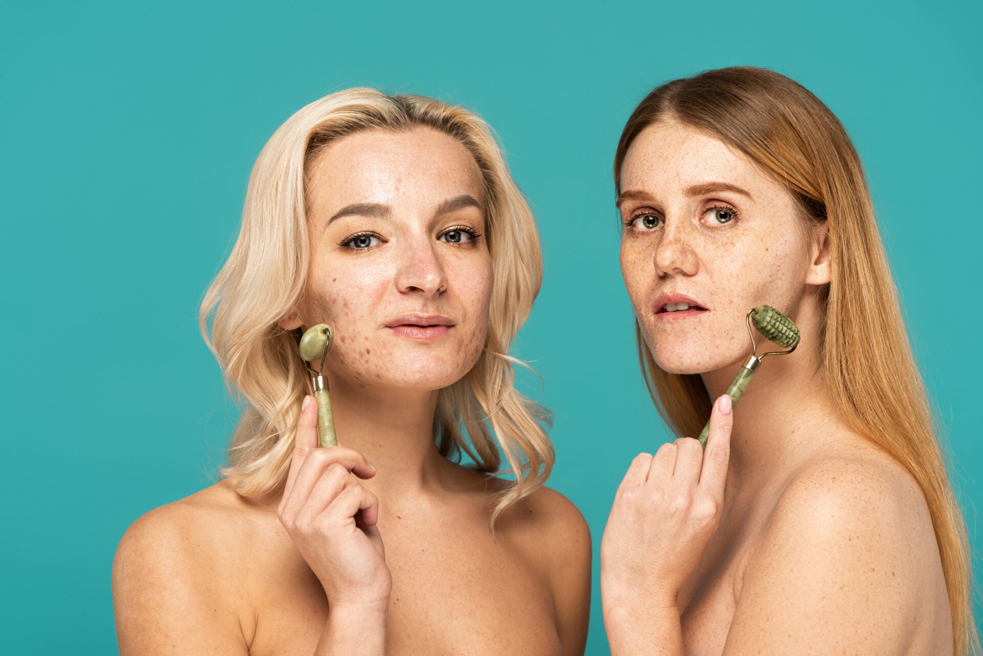 Two women using non-toxic anti-acne products 